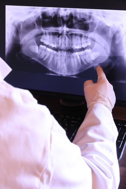 Best Emergency Dentist for Knocked-Out Tooth in New Hackensack, NY
