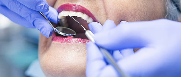 Best Broken or Cracked Tooth Emergency Dentist in New Hackensack, NY